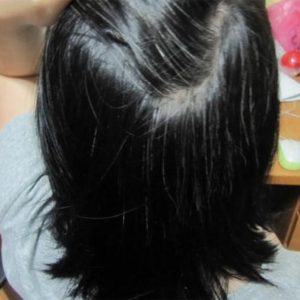 Hà thủ ô – Trị tận gốc tóc bạc sớm